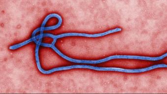 Imatge del virus de l'Ebola al microscopi