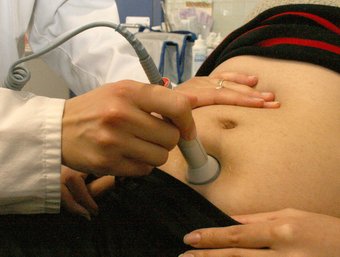 Control mèdic en una embarassada ROSA BONCOMPTE