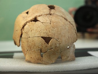 El crani trobat fa 41 anys a Serinyà JOAN SABATER
