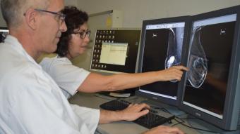 Radiòlegs revisant un mamografia